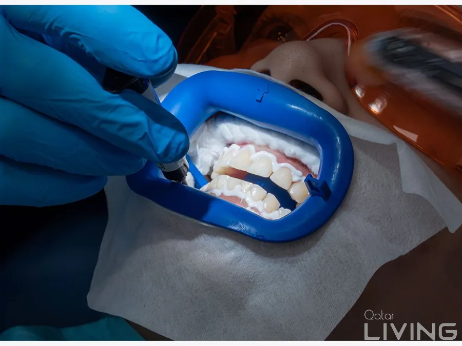 Zoom Teeth Bleaching – 1750 QAR